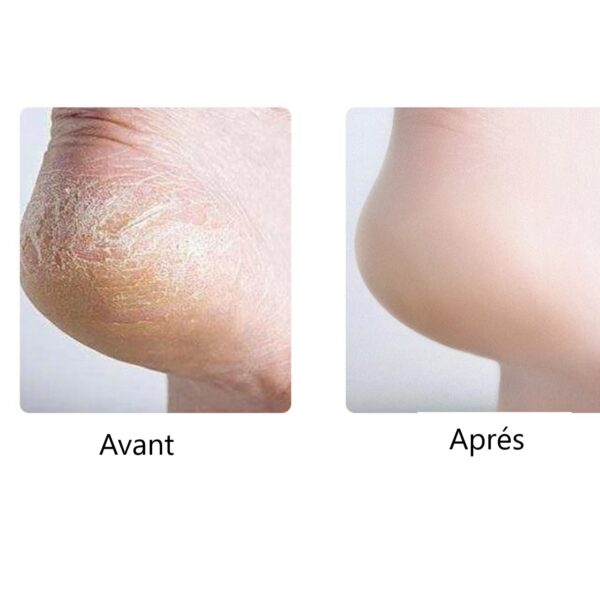 Épurateur Exfoliant Des Pieds Avec 2 Vitesses & 3 Têtes – Image 2